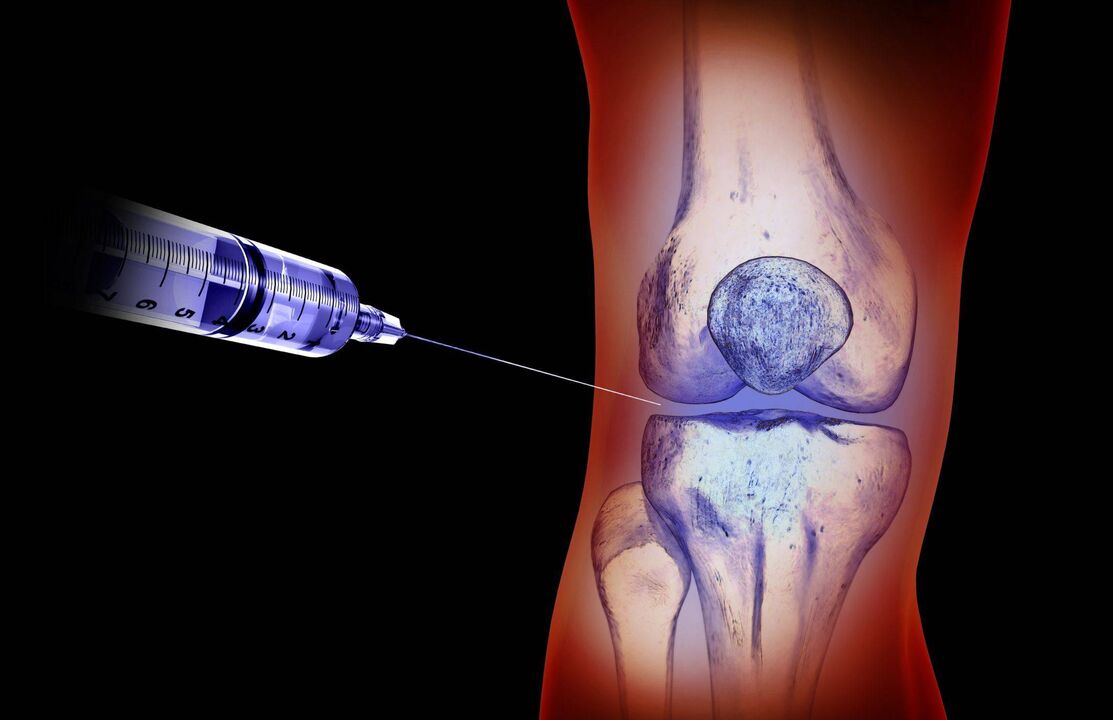 Intra-articular injections for arthrosis